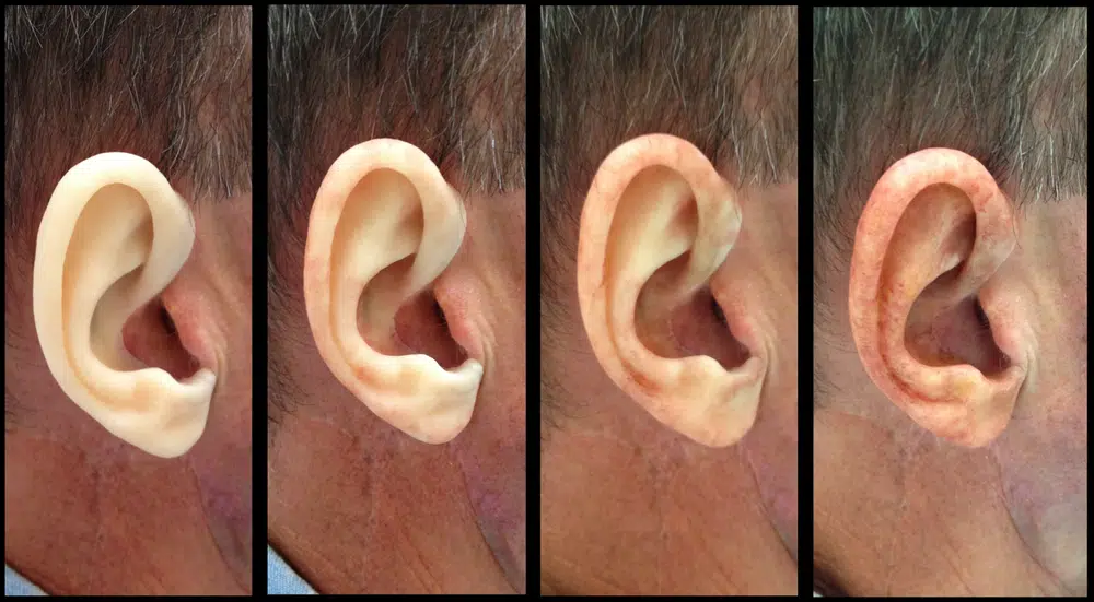 Four ears displaying varying skin tones showing anatomical structure and diversity in human appearance.